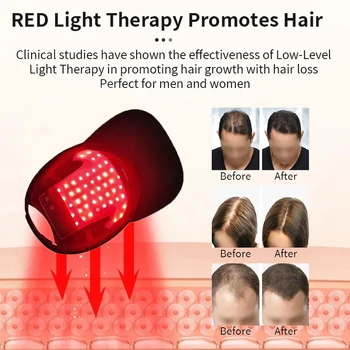 2023 Păr Regenera Utilizarea Acasă Roșu Albastru Pălărie De Lumină Led-Uri Scalp Therapy Capac Pentru Caderea Parului Cu Laser Capac Cresterea Parului
